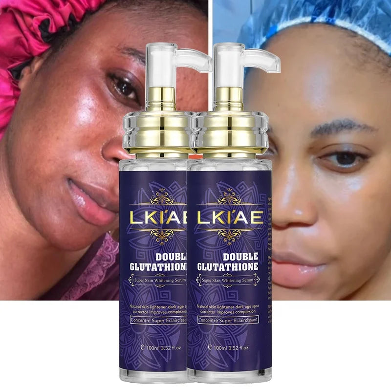 Oem Hyperpigmentation Traitement Bleaching Moisturizer Skin Care Facial 20% Vitamin C Whitening Beauty Serum for Face