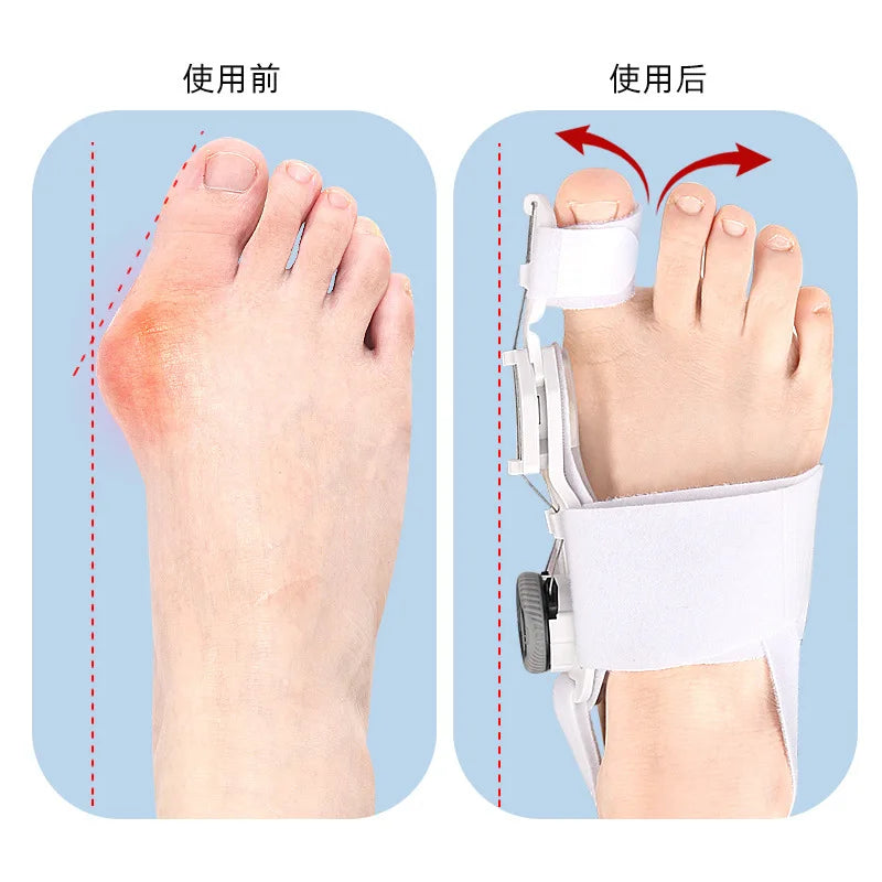 Toe Separator  Bunion Relief Orthopedic Toe Straightener Adjustable Knob Bunion Splint for Bunion Relief