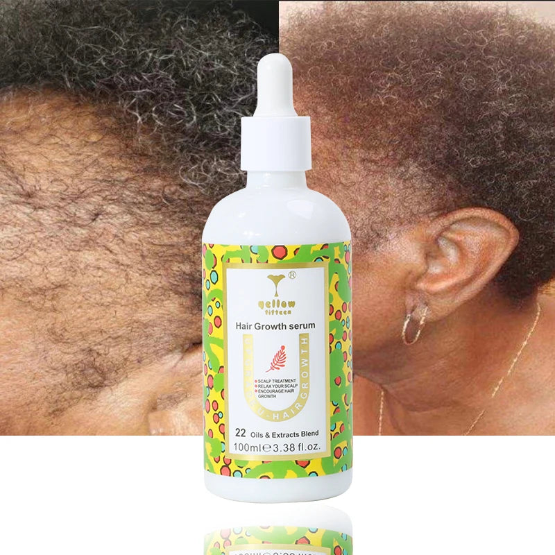 Natural Organic Hair Growth Oil for Men and Women