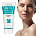 ALIVER Hot Selling Melasma Blemish Pimples Dark Spot Remover Cream Best Whitening Freckles Removal Face Cream