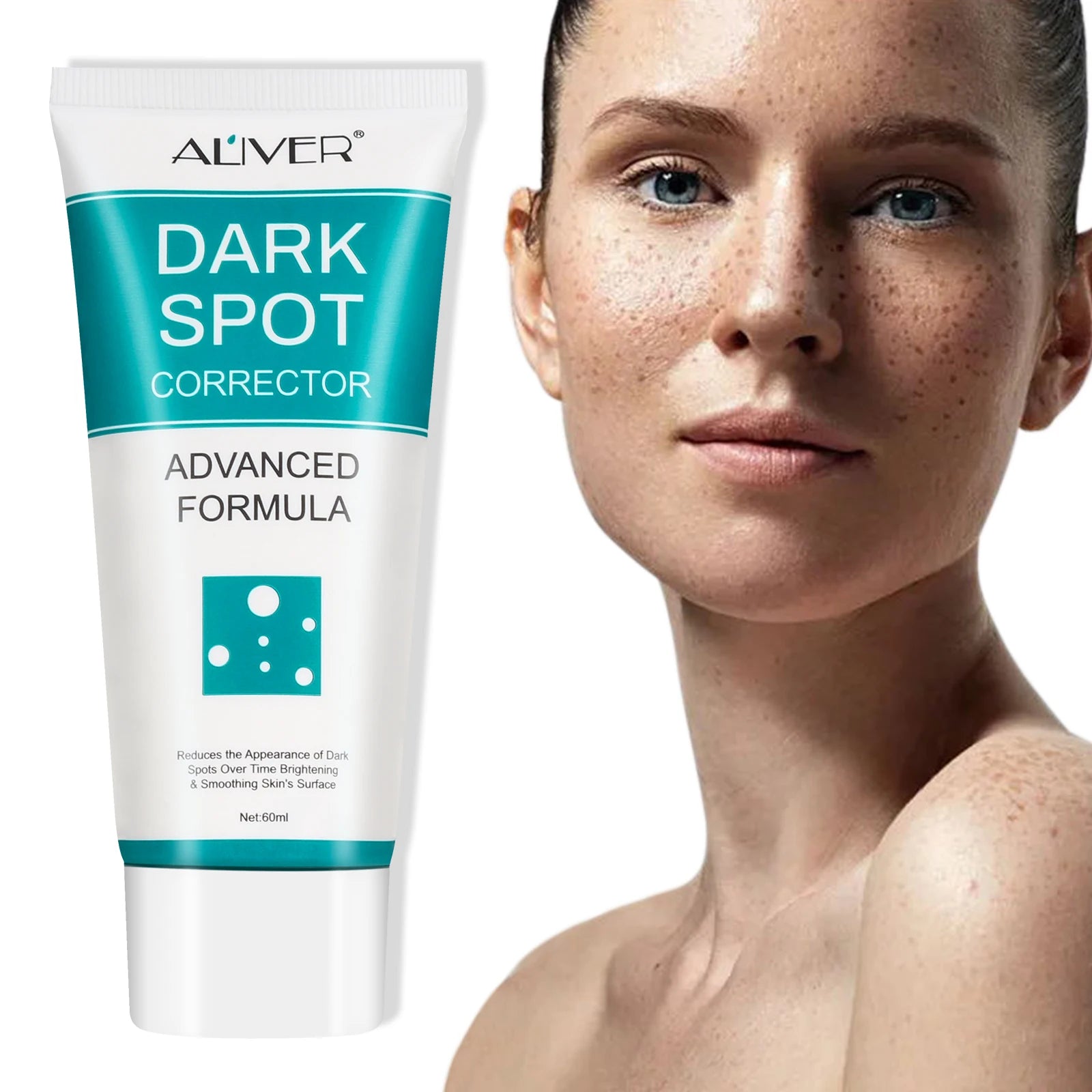 ALIVER Hot Selling Melasma Blemish Pimples Dark Spot Remover Cream Best Whitening Freckles Removal Face Cream