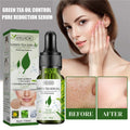 EELHOE Face Whitening Essence Niacinamide Anti Oxidation Pores Shrinking Oil Controlling Skin Hydrating Firming Green Tea Serum