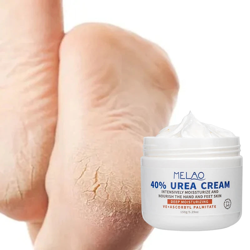 Private Label Hydrating Calluses Remover Urea Foot Cream