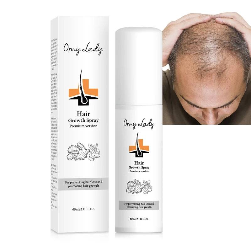 Sample Omy Lady Herbal Formula Hair Regrowth Treatment Foam Hair Growth Spray