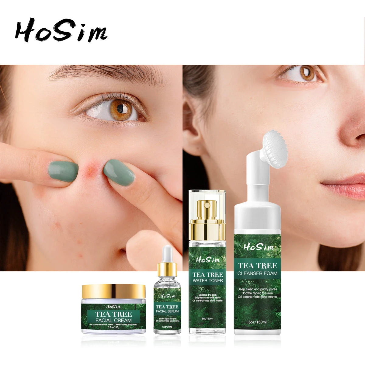 Tea Tree Acne Scar Removal Skin Care Set 4-Piece Facial Serum Cream Toner Cleanser Foam with Witch Hazel & AHA-Luxurious Formula