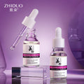 OEM Private Label ZHIDUO Spot Removal Serum Lightens Pigmentation Skin Brightening Skin Spot Face Serum