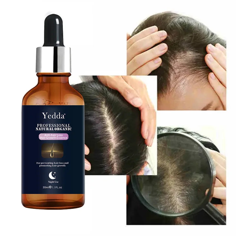 Customized Self-owned Brand Rapid Growth Organic Essential Oil Set 30ml Herbal Squalane Unisex Damage Repair Curling Hair