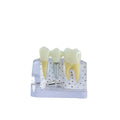 Oral Teaching Simulation Model Plastic Dental Implant with Removable Teeth Multi-Purpose Teeth Whitening Accessories