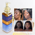 Wholesale Serums Anti Aging Kojic Acid Super Retinol Body Face Hand Skin Care Whitening Serum for Black Skin
