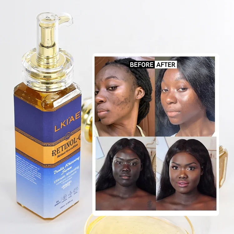 Wholesale Serums Anti Aging Kojic Acid Super Retinol Body Face Hand Skin Care Whitening Serum for Black Skin