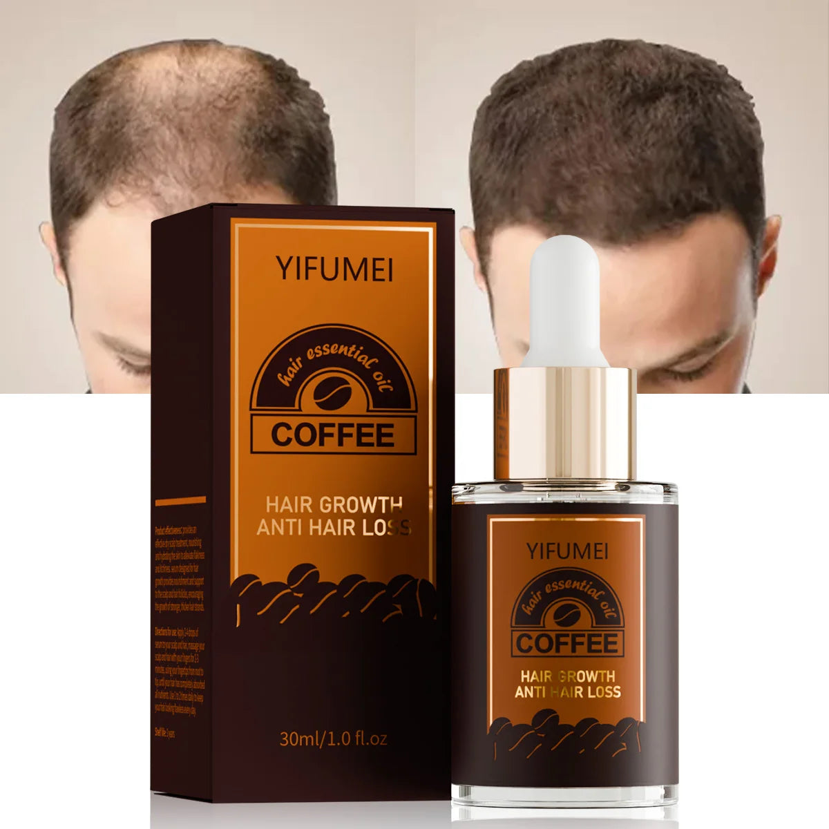 Stock Natural Hair Growth Serum Oil Organic Caffeine Scalp Regrowth Treatment Repair Damage Hair Growth Serum