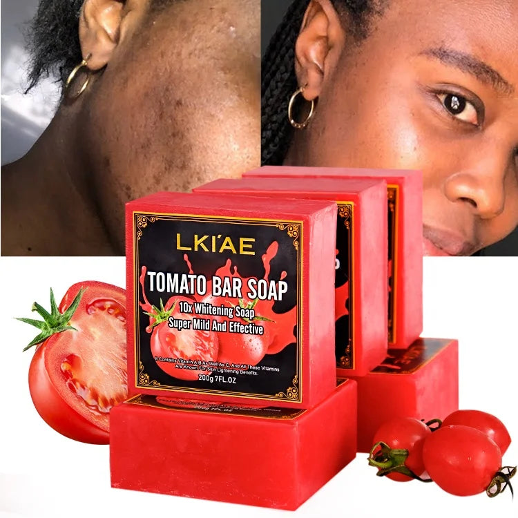 Thailand Whitening Products Tropical Fruit Dark Spot Remover Lightening Extract Skin Care Organic Natural Soap Handmade