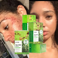Private Label Tea Tree Soap Glycerin Base Skin Lightening Face Remove Acne Body Bathing Whitening Soap
