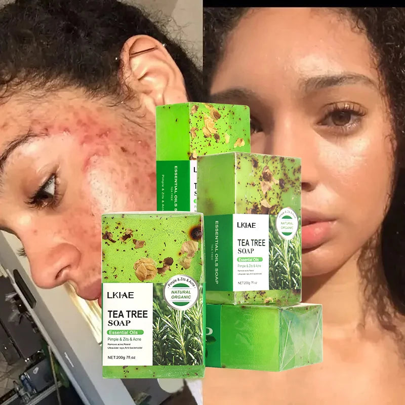 Private Label Tea Tree Soap Glycerin Base Skin Lightening Face Remove Acne Body Bathing Whitening Soap
