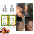 Herbal Essence Scalp Men Woman Hair Growth Oil Growing Rosemary American Essential Bumps Anti Tonic Natural