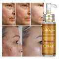 OEM Beauty Serum Natural Moisturizing Skin Brightening Organic Collagen Kojic Acid Whitening Body Serum for Body&Face