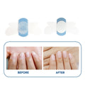Beauty Hydrogel Patches for Broken Nails Keratin Gel Patch Waterproof Nail Sticker for Fungus