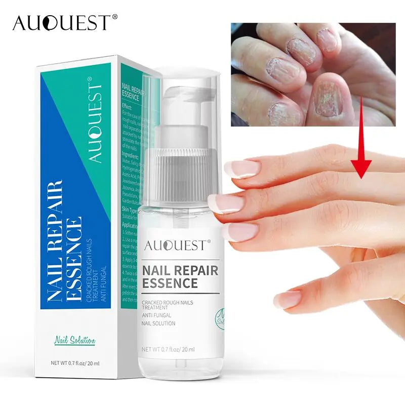 Manufacturer Private Label Custom Logo Repair Cracked and Rough Nail Anti Fungal Solution Toenail Fungus Nail Treatment