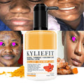 Turmeric Vitamin C Face Dry Skin Rescue Cream Brightening Anti Aging Moisturizer Lotion With Vitamin E Ginger for Age Spots