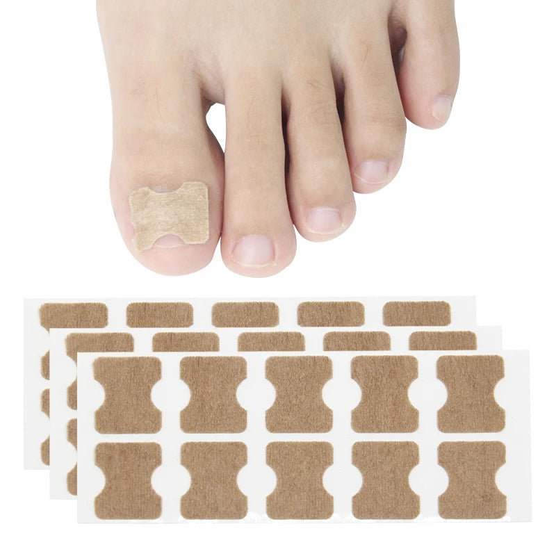 1 SET 100PCS Ingrown Toenail Treatment Glue Free Breathable Toenail Corrector Patch