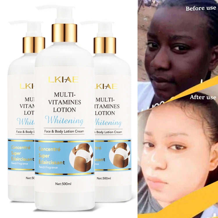 OEM Body Skin Care Product Best Skin Whitening Cream Lightening Bleaching Body Lotion for Black Skin