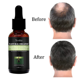 OEM 30ml Natural Organic Lightweight Hair Growth Essence Oil Pure Hair Care Products for Men Fast Fall Hair Regrowth Treatment