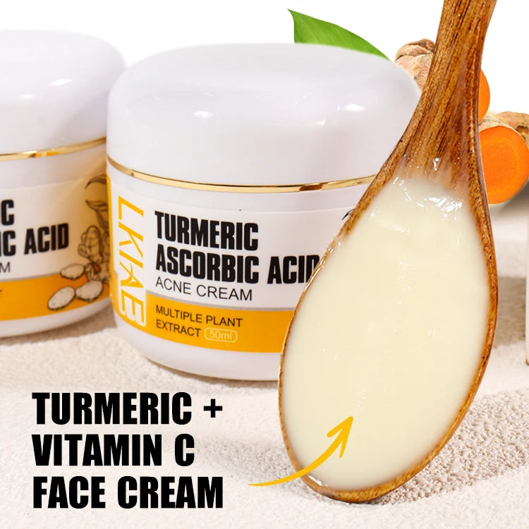 Private Label Niacinamide & Turmeric Vitamin C Face Anti Pimple Fade Spot Acne Scar Removal Cream for Skin