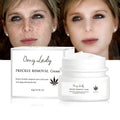 2023 Omy Lady New Skin Care Line Quick Results Function Face Cream for Removing Pigmentation & Sunburn Spot
