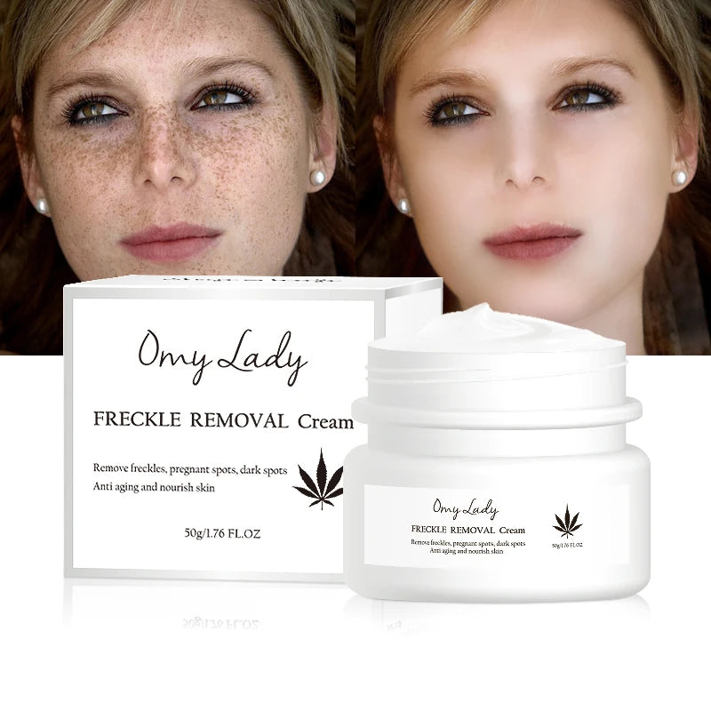 2023 Omy Lady New Skin Care Line Quick Results Function Face Cream for Removing Pigmentation & Sunburn Spot