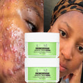 OEM&ODM Day Cream Acne & Dark Spot Removal Kit with Collagen & Glycerin for Sensitive Skin