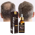 OTVENA 28 Days Repair Baldness Prevent Hair Loss Smooth Nourish Black Beard Hair Growth Oil Serum Wholesale Custom