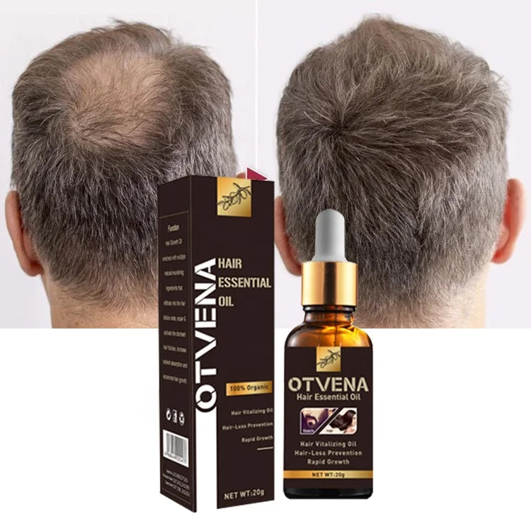 OTVENA 28 Days Repair Baldness Prevent Hair Loss Smooth Nourish Black Beard Hair Growth Oil Serum Wholesale Custom