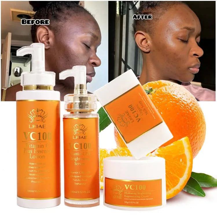 Privated Label Whitening Lightening Face Cream Body Lotion Serum Soap Face Care Vitamin C Skin Care Set for Face