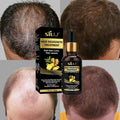 SILU Anti-hair Loss Treatment Clothes Hair Growth Ginger in India logo Hair Loss Treatment