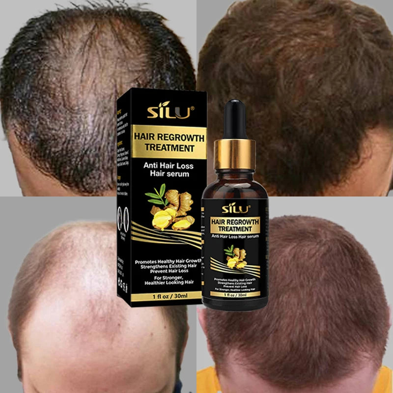 SILU Anti-hair Loss Treatment Clothes Hair Growth Ginger in India logo Hair Loss Treatment
