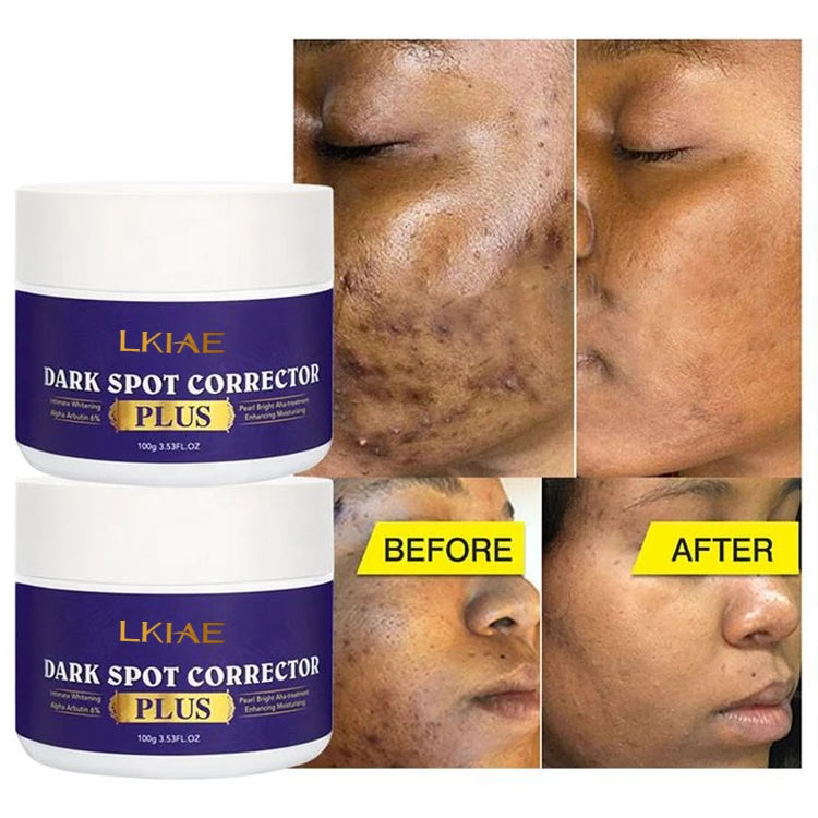 Wholesale Multiuses Under Arms Inner Thigh Neck Intimate Sensitive Dark Skin Bleaching Lightening Body Whitening Cream