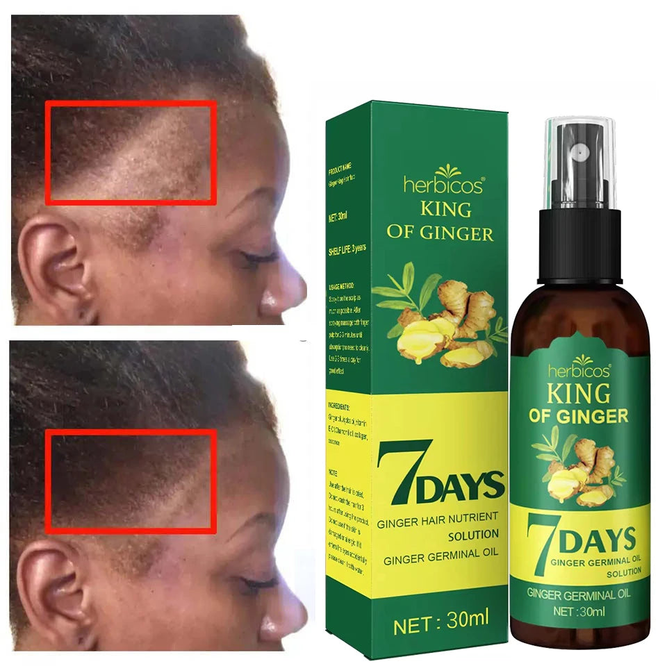 Herbicos Green Ginger Anti-Hair Prevent Loss OilGinger 7 Days Hair Growth Nourishing Regrowth SprayKing of Ginger Spraying