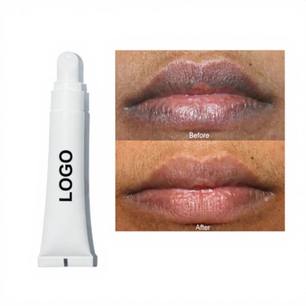 Custom Lip Whitening Treatment Peptide Collagen Lips Treatment Private Label