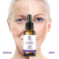 Perfect Care Brand Anti-Wrinkle Whitening Hyaluronic Acid Facial Serum for Reducing Fine Lines with Free Sample