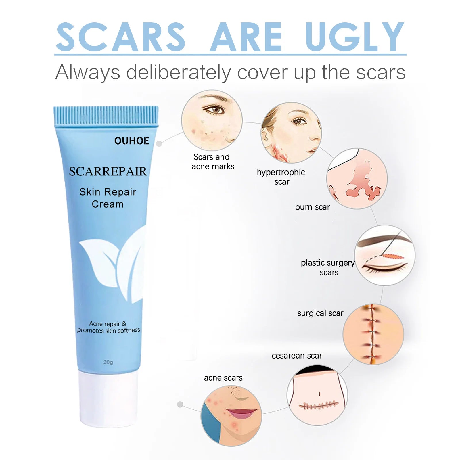 Low Moq Anti Vergeture Repair Scar Removal Cream Acne Scar Removal Cream Remove Scars Acne Cream