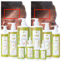 OEM/ODM 100% Natural Organic Peppermint Hyaluronic Acid Coconut Oil Leave-In Anti-Hair Loss Anti-Dandruff Hair Growth Oil for