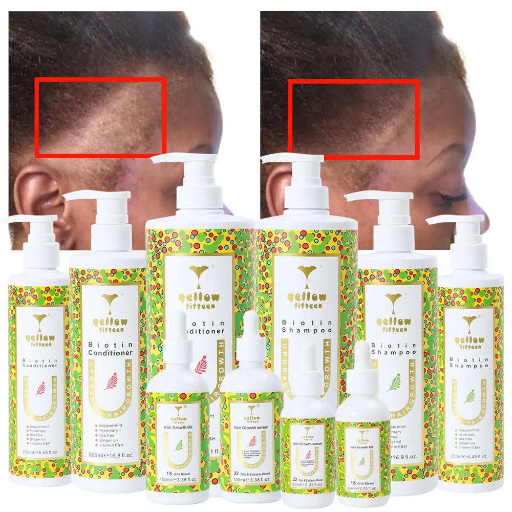 OEM/ODM 100% Natural Organic Peppermint Hyaluronic Acid Coconut Oil Leave-In Anti-Hair Loss Anti-Dandruff Hair Growth Oil for