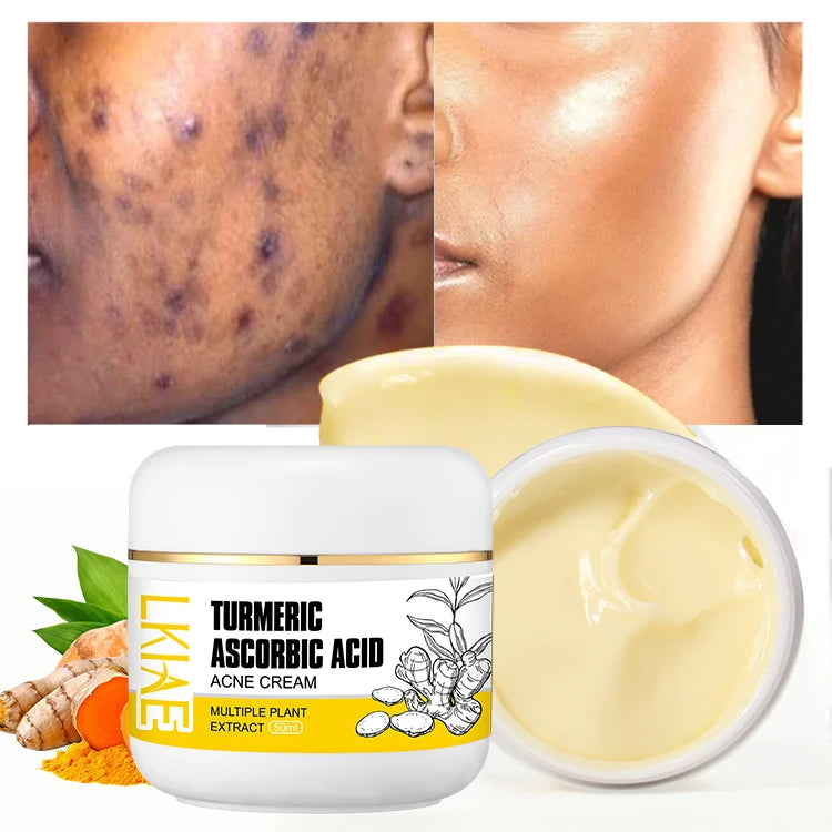 Private Label 3 Days Glowing Repair Face Spot Skin Brightening Turmeric Removal Pimples Cream for All Skin Types