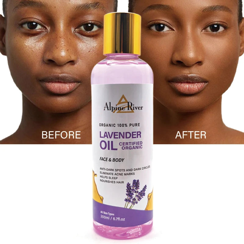 Private Label Alpine River Body Oil Niacinamide Hyaluronic Acid Vitamin E for Removing Dark Spots Pure Natural Lavender Sleep