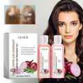 OUHOE 200ml Onion Biotin Shampoo Conditioner Set Moisturizing Anti Loss Growth Promoting Rosemary Shampoo and Conditioner Set