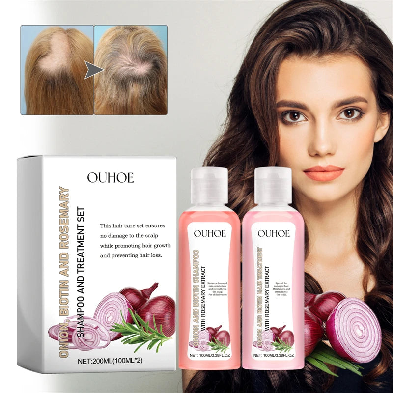 OUHOE 200ml Onion Biotin Shampoo Conditioner Set Moisturizing Anti Loss Growth Promoting Rosemary Shampoo and Conditioner Set