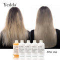 Yedda Anti-Dandruff Nourishing Damaged Hair Repair Set with Shampoo Conditioner Serum & Gel (250ml*5)