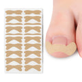 High Elasticity Ingrown Foot Care Toenail Corrector Patch Nail Healing Corrector Treatment Tool