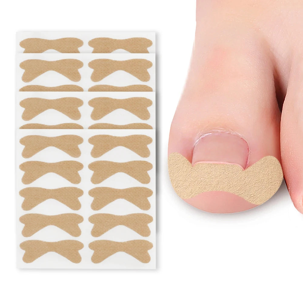 High Elasticity Ingrown Foot Care Toenail Corrector Patch Nail Healing Corrector Treatment Tool