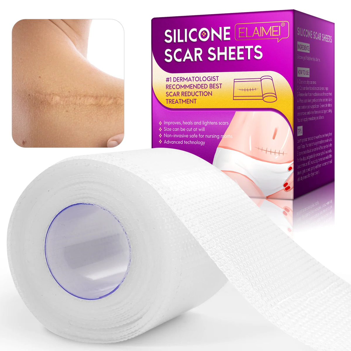 ELAIMEI Best Keloid Tummy Tuck Silicon Scar Treatment Tape Products Professional Clear Silicone Scar Sheets for Skincare MegaBDM